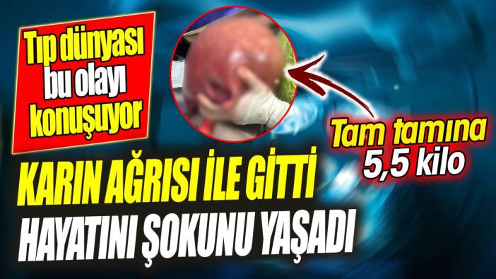 Karın ağrısı ile gitti hayatını şokunu yaşadı. Tıp dünyası bu olayı konuşuyor 'Tam tamına 5,5 kilo'