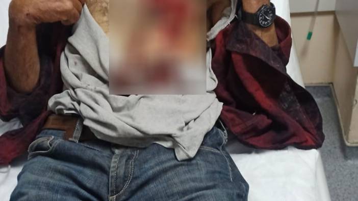 Hayvan otlatırken yaban domuzunun saldırısına uğradı