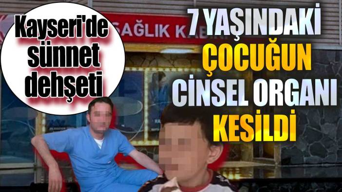 Kayseri'de sünnet dehşeti' 7 yaşındaki çocuğun cinsel organı kesildi