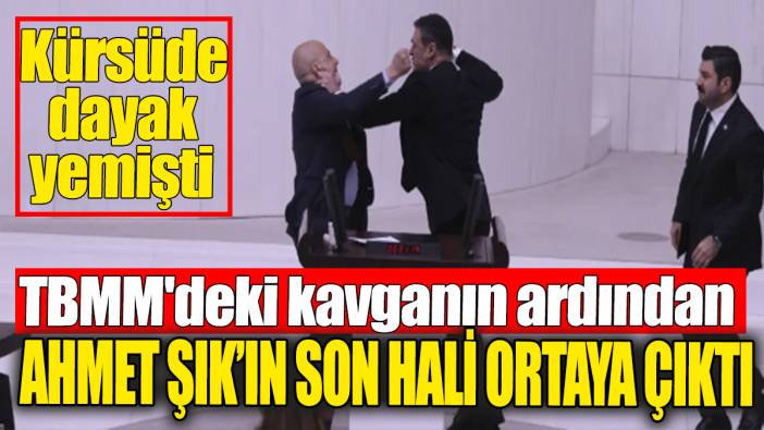 TBMM'deki kavganın ardından Ahmet Şık'ın son hali ortaya çıktı