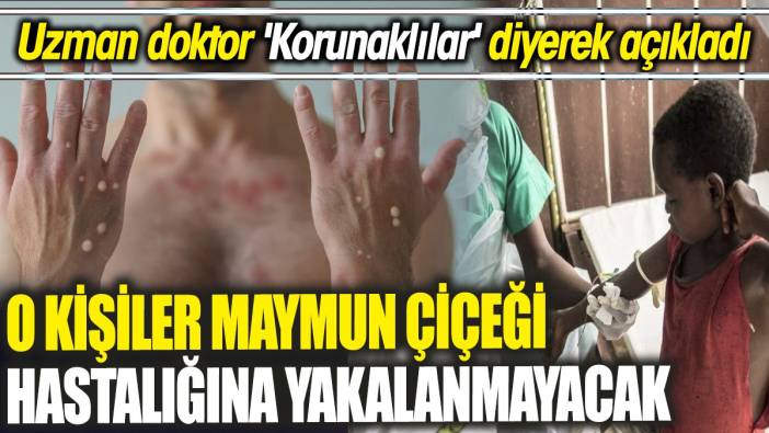 O kişiler Maymun Çiçeği hastalığına yakalanmayacak 'Uzman doktor 'Korunaklılar' diyerek açıkladı'