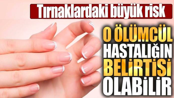 Tırnaklardaki büyük risk: O ölümcül hastalığın belirtisi olabilir