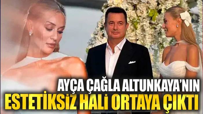 Ayça Çağla Altunkaya'nın estetiksiz hali ortaya çıktı