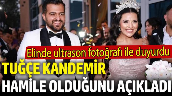 Tuğçe Kandemir hamile olduğunu açıkladı! Elinde ultrason fotoğrafı ile duyurdu