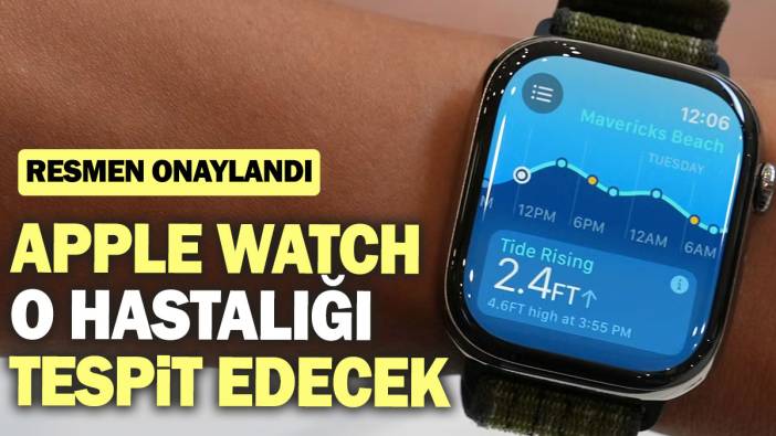 Apple Watch o hastalığı tespit edecek: Resmen onaylandı