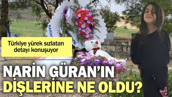 Narin Güran’ın dişlerine ne oldu? Türkiye yürek sızlatan detayı konuşuyor