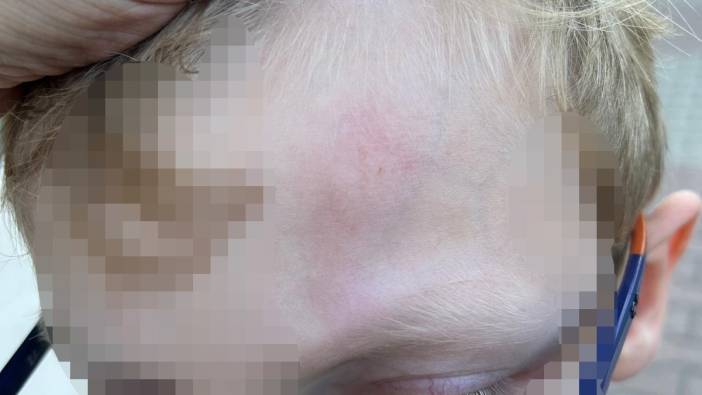 Beylikdüzü'nde okulda öğrenciye demir çubukla darp