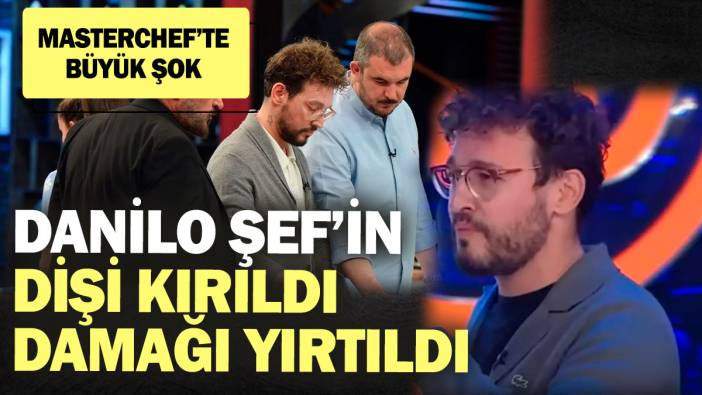 MasterChef’te büyük şok! Danilo Şef’in dişi kırıldı damağı yırtıldı!