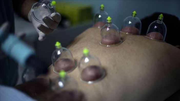 Dr. Saraç: Yılda iki kez hacamat yaptırın