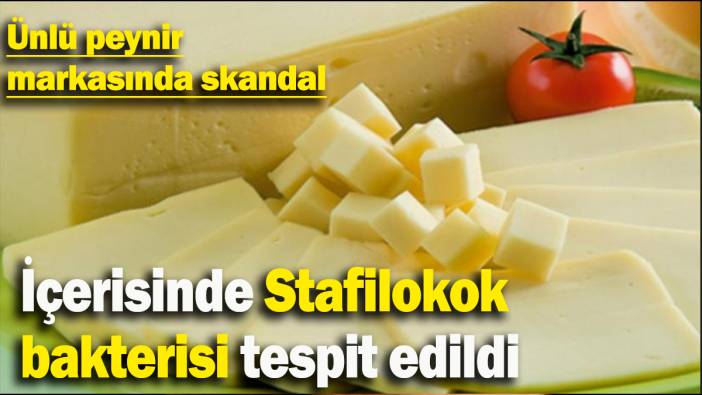 Ünlü peynir markasında skandal: İçerisinde Stafilokok  bakterisi tespit edildi