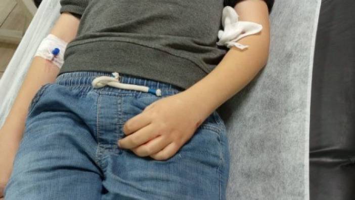 Akhisar'da köpeğin saldırısına uğrayan çocuk yaralandı