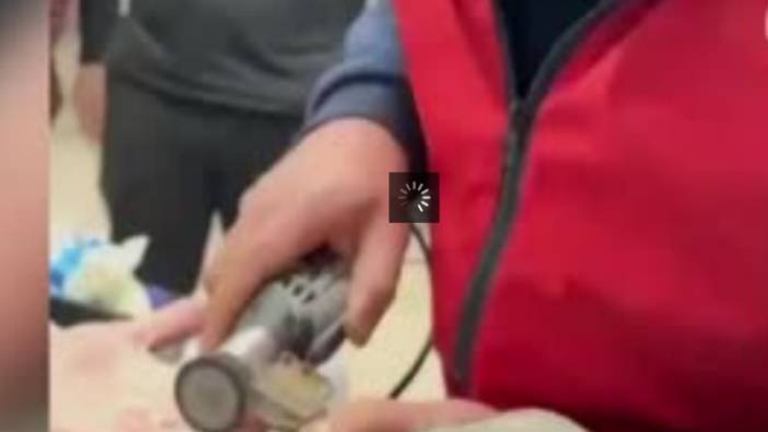 Parmağına sıkışan yüzüğü itfaiye çıkardı