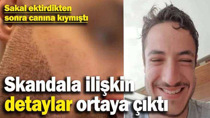 Sakal ektirdikten sonra canına kıymıştı! Fransız TV programı skandala ilişkin detayları ortaya çıkardı