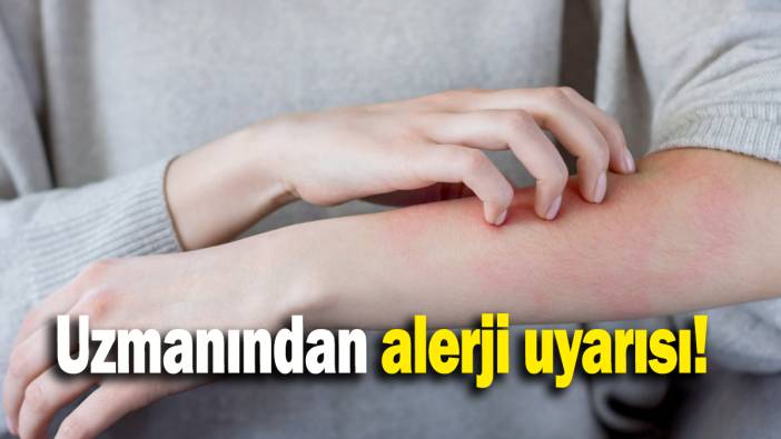 Uzmanından alerji uyarısı
