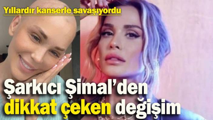 Şarkıcı Şimal'den dikkat çeken değişim: Yıllardır kanserle savaşıyordu