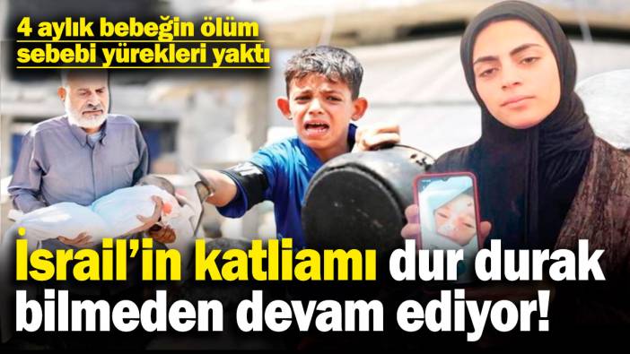 İsrail'in görülmemiş katliamı devam ediyor! 4 aylık bebeğin ölüm sebebi yürekleri yaktı