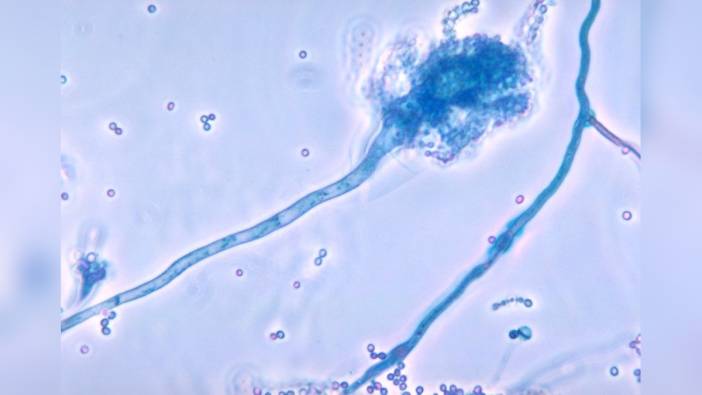 Küresel ısınma, ölümcül mantarın yayılmasını hızlandırabilir