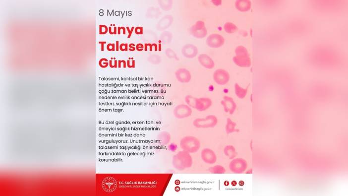 Eskişehir İl Sağlık Müdürü Bildirici'den 8 Mayıs Dünya Talasemi Günü mesajı