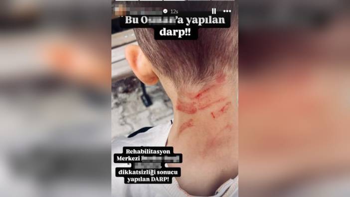 Burdur'da özel gereksinimli çocuğa darp iddiası: Soruşturma başlatıldı