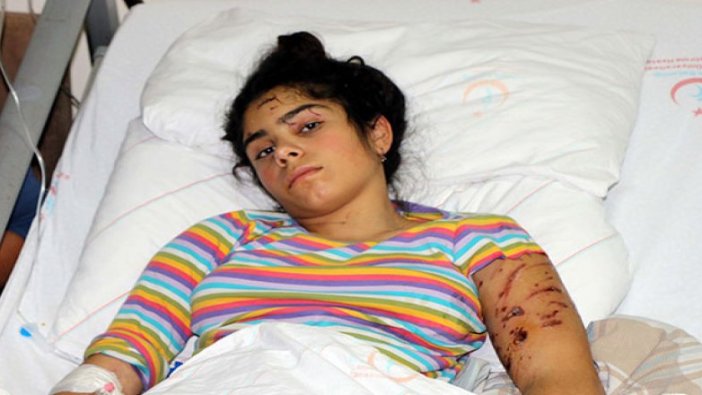 6 köpeğin saldırdığı kız tedavi altına alındı