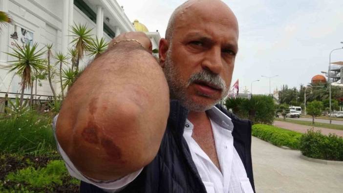 Antalya'da esnaf derneği başkan yardımcısına saldırı: Kaçak yapılarla mücadeleye tepki