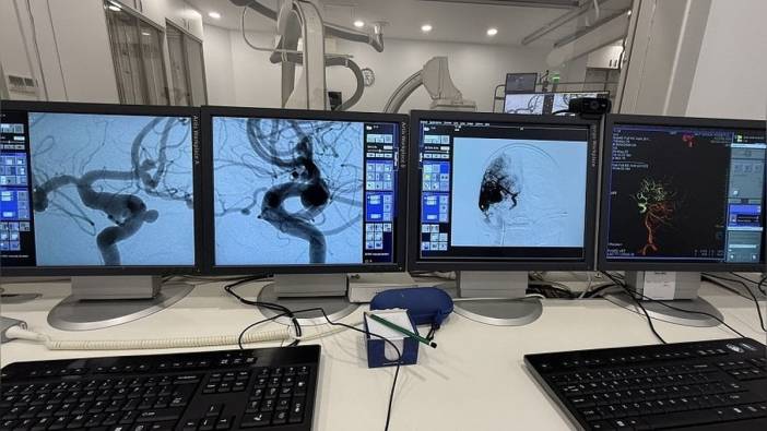 Türk nöroradyologları, Şanghay'da 3 bin doktora beyin damar hastalıklarının tedavisini anlatacak