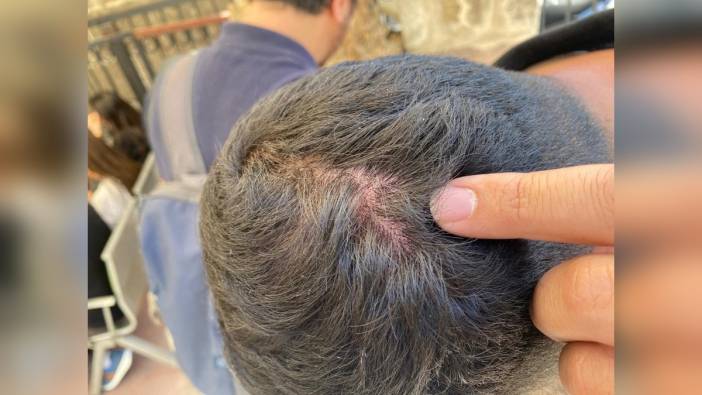 İzmir'de miting hazırlığında vinç kazası: Gazeteciler darbedildi