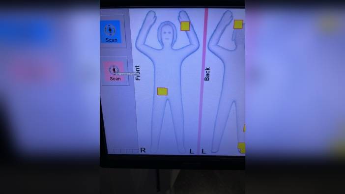 İstanbul Havalimanı'nda operasyon: Özbekistanlı kadınların cinsel organlarından 6 kilo altın çıktı