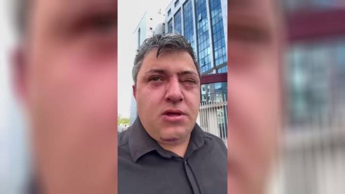 Altındağ Belediye Başkanı Tiryaki hakkında darp iddiası: 20 dakika darba maruz kaldım