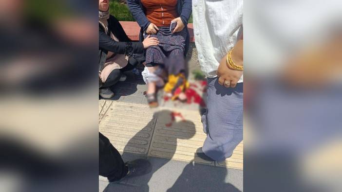 Ankara'da silahlı kavgada yoldan geçen kadın yaralandı