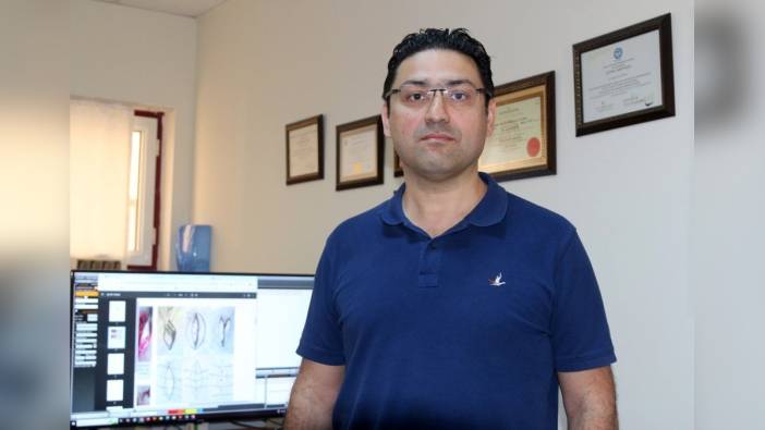 Akdeniz Üniversitesi'nde kıl dönmesi tedavisinde çığır açan yöntem