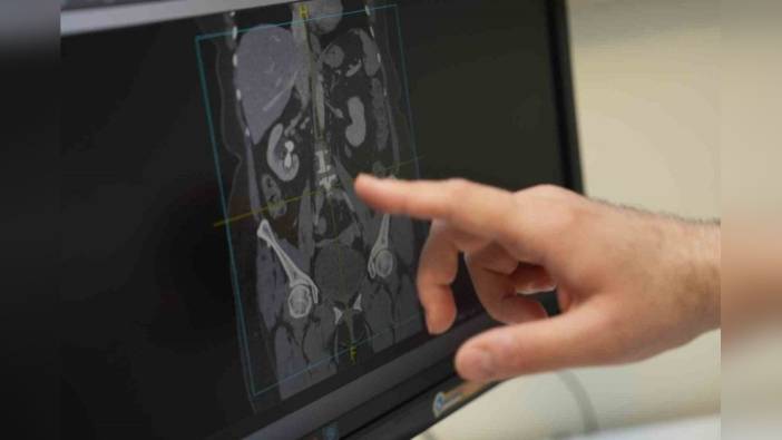 Doç. Dr. Yenice'den erkek cinsel sağlığı için beslenme önerileri