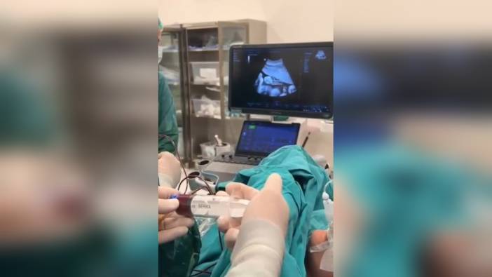 Batman'da 8 aylık bebeğe anne karnında kan nakli yapıldı