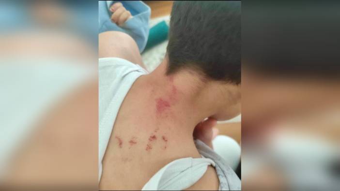 Şanlıurfa'da 10 yaşındaki öğrencisini darbeden öğretmen tutuklandı