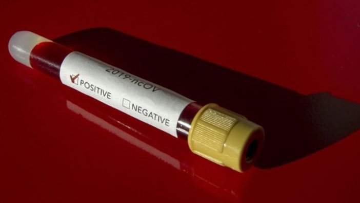 Polonya’da Kovid-19 nedeniyle ilk ölüm