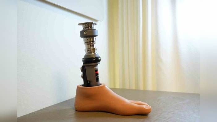 Prof. Dr. Adnan Kara: Osseointegrasyon yöntemi, amputasyon hastalarına umut oluyor