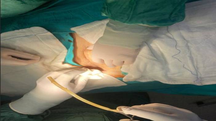 Doktorun hatası hayatını kabusa çevirdi