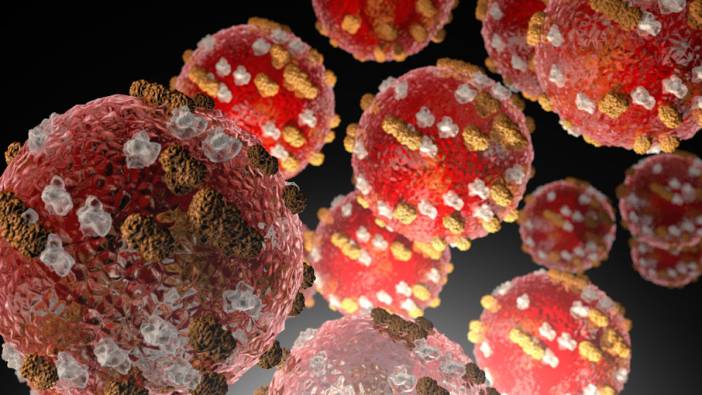 Kızamık salgını can aldı! 17 kişi hayatını kaybetti