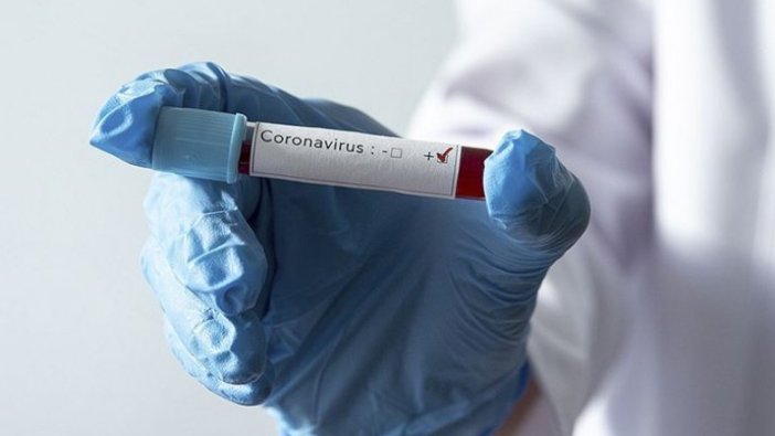 Dünya genelinde Kovid-19 vaka sayısı 1 milyon 700 bini aştı