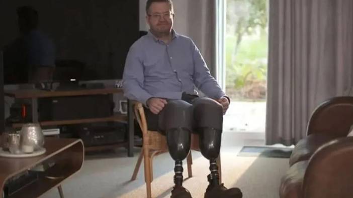 Bacaklarını kesen cerrah hayrete düşürdü!