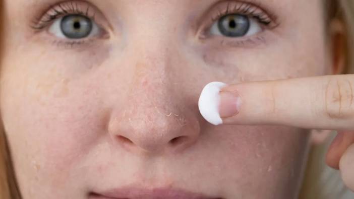 Kuruyan cilt kabusunuz olmasın! İşte püf noktalar