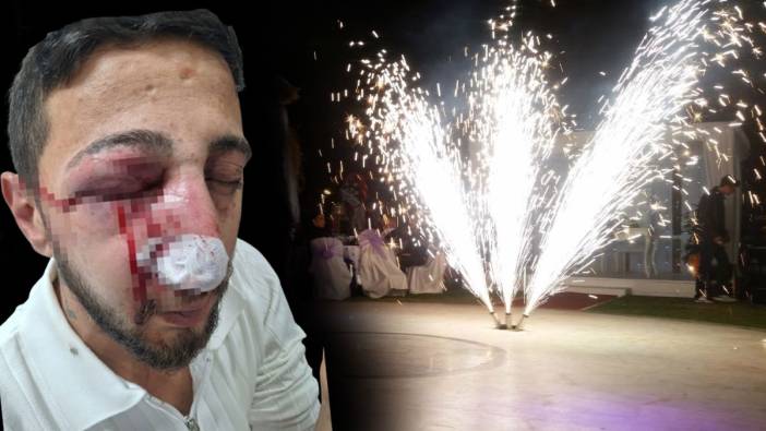 Düğün eğlencesi kabusa döndü!