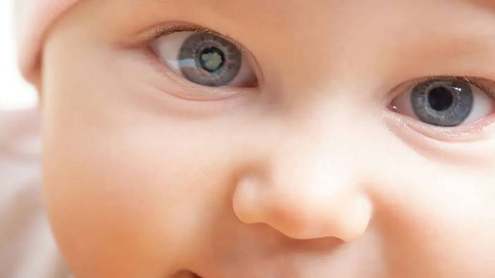 Çocuklarda katarakt tehlikesi!