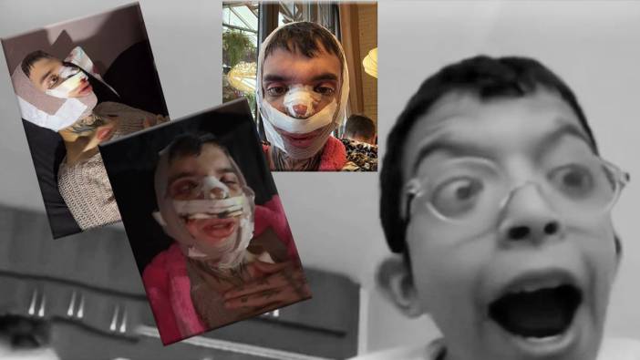 Eleştirilere daha fazla dayanamadı! Tablet reis bıçak altına yattı