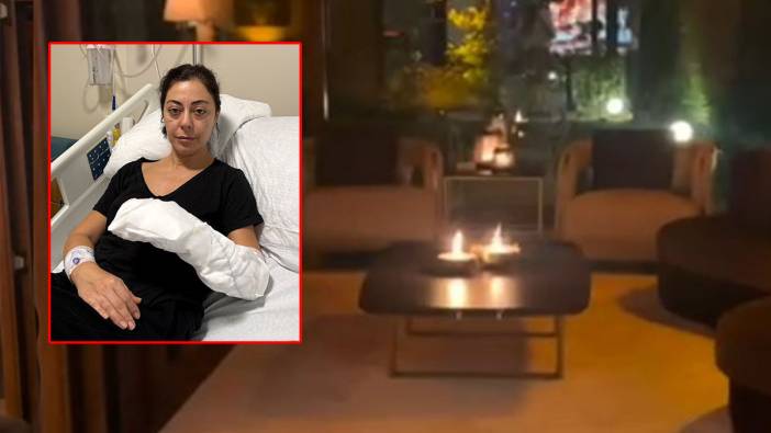 Şömine keyfi kabusa döndü! Vücudunun yüzde 30'u yandı