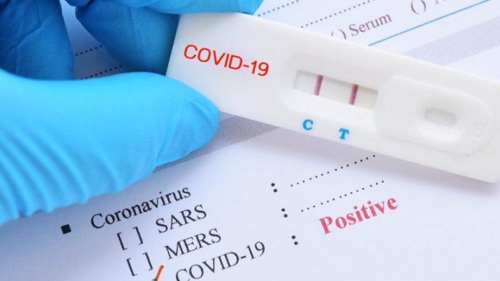 Almanya Kovid-19 test stratejisi güncellendi