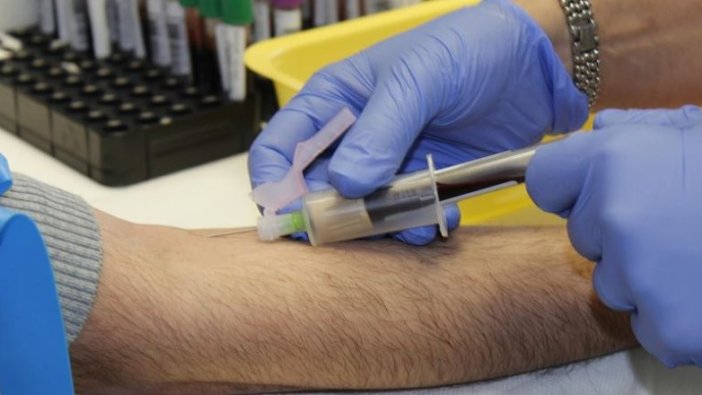 Kovid-19 damarların içinde pıhtı oluşumunu tetikliyor