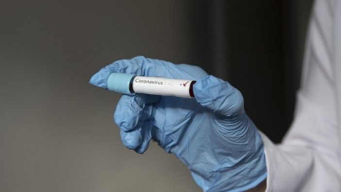 Koronada ilaç kullanmamak hastalığı olumsuz etkiliyor