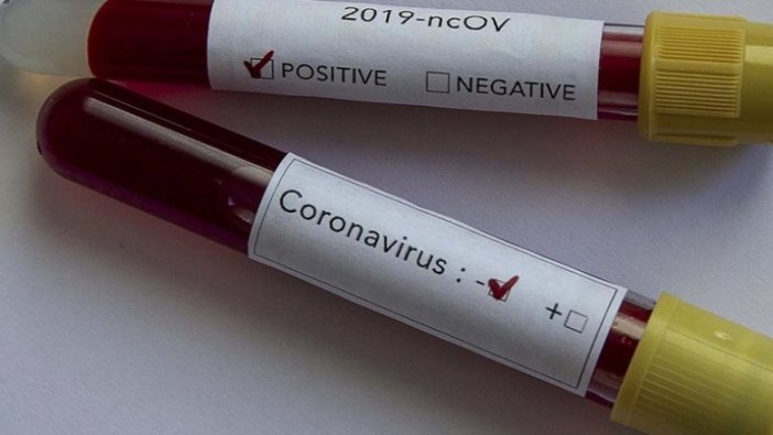 Antarktika'da ilk Kovid-19 vakaları görüldü