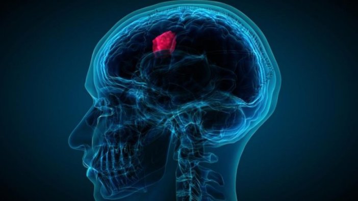 Bilim insanları kansere umut olacak diyerek duyurdu